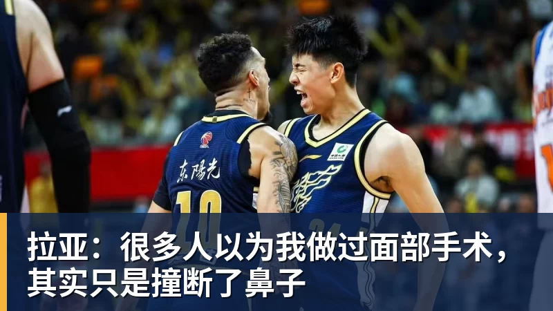 拉亚：很多人以为我做过面部手术，其实只是撞断了鼻子